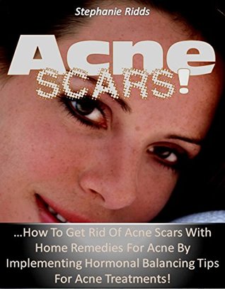 Download Acne Scars!: How to Get Rid Of Acne Scars with Home Remedies for Acne by Implementing Hormonal Balancing Tips for Acne Treatments! - Stephanie Ridd file in ePub