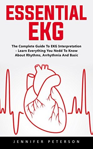 Download Essential EKG: The Complete Guide To Ekg Interpretation - Learn Everything You Need To Know About Rhythms, Arrhythmia And Basic Cardiac Dysrhythmias! - Jennifer Peterson | ePub
